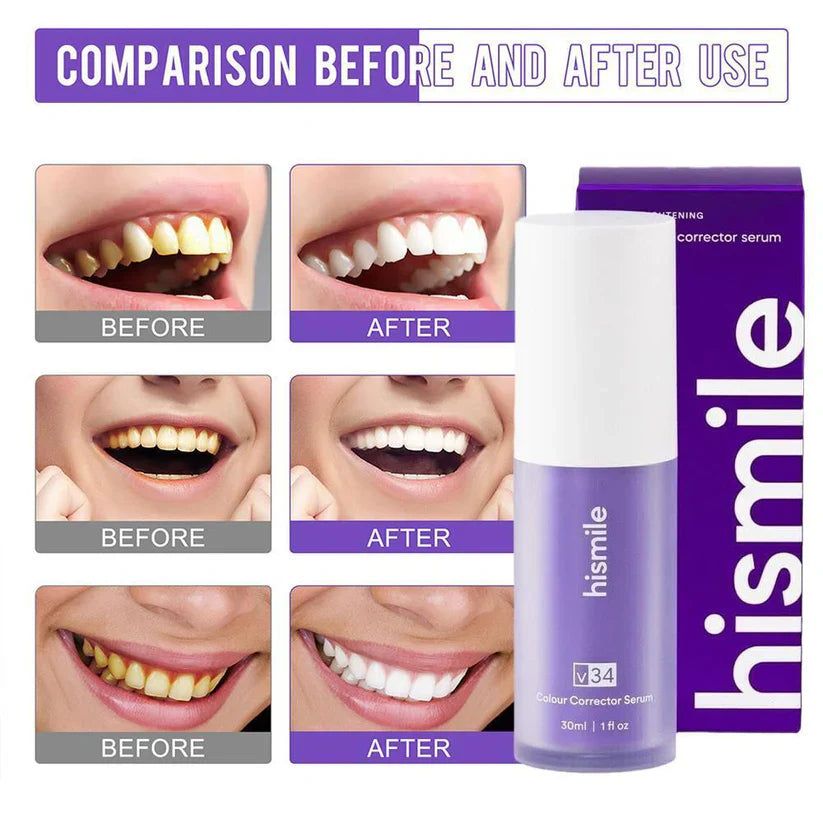 HiSmile - V34 Colour Corrector Serum